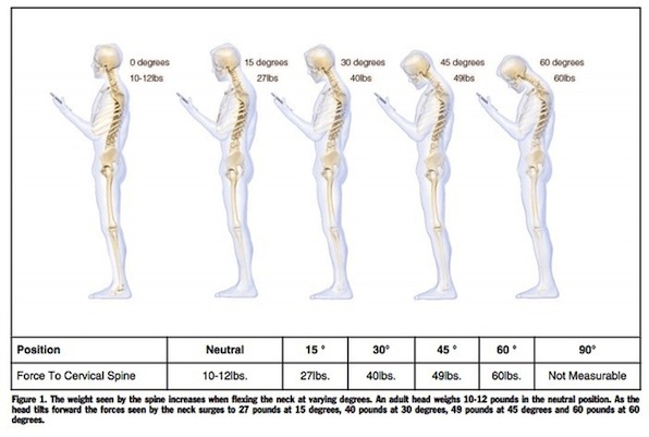 Amount of weight on your neck when having "text neck"