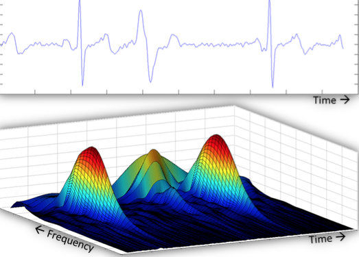 Figure 1A consists of images of three different screens. They show real time processing of physiological waveforms to recognize patterns and provide input to machine learning systems. At U-M, the computer systems can continuously record and store data from any given patient.